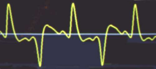 waveform from front edge pickup next reed over showing slight differences